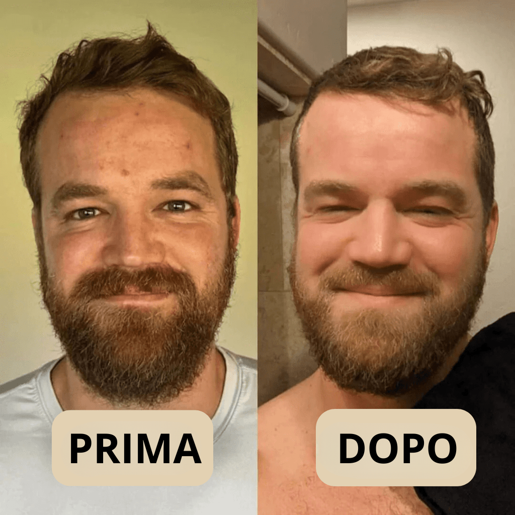 Peel Shot Coreano, elimina le impurità e valorizza la tua pelle