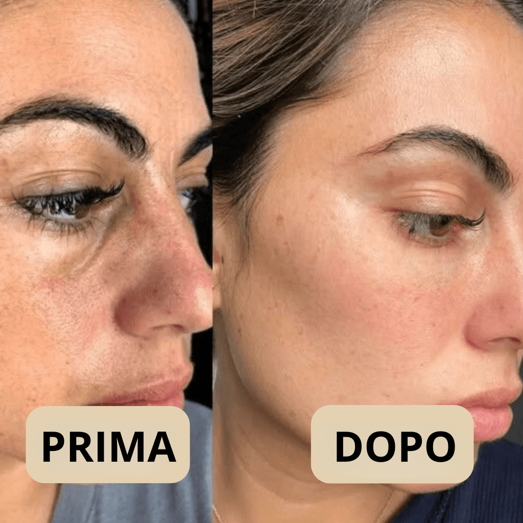 Peel Shot Coreano, elimina le impurità e valorizza la tua pelle