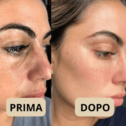 Peel Shot Coreano, elimina le impurità e valorizza la tua pelle