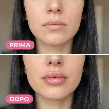 Volumizzante Labbra Cosymera